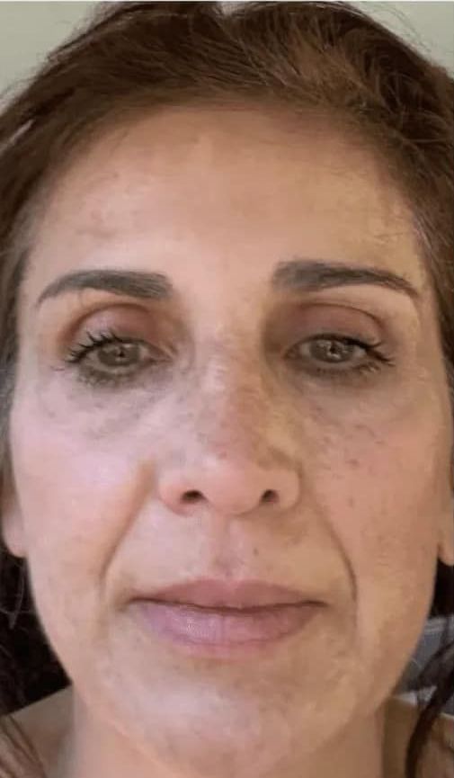 A close up of a woman 's face without makeup.
