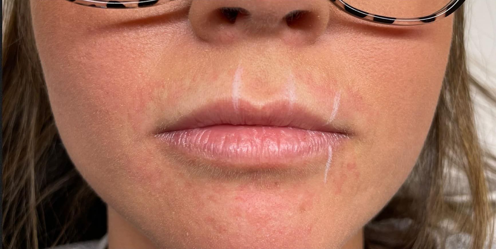 A close up of a woman 's mouth with glasses on.