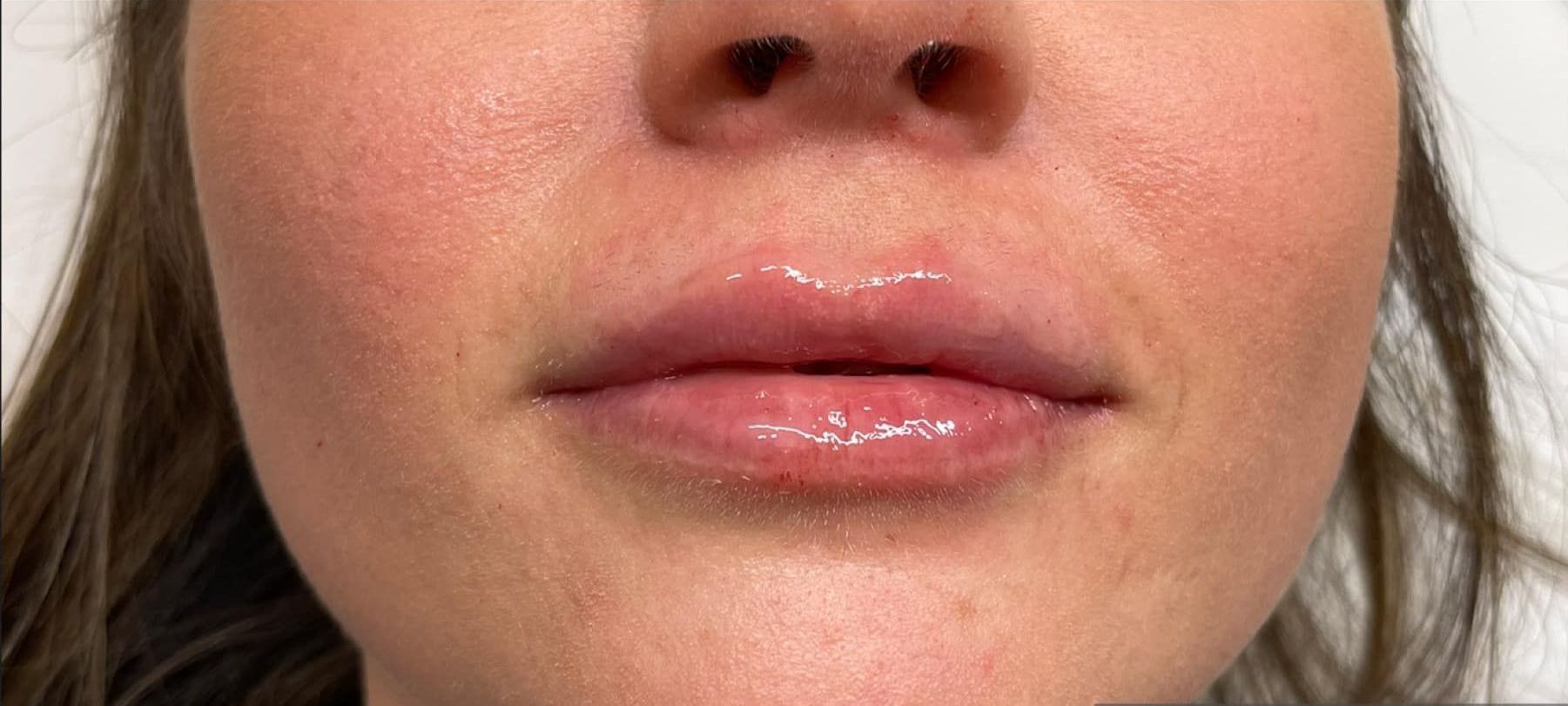 A close up of a woman 's lips and nose.