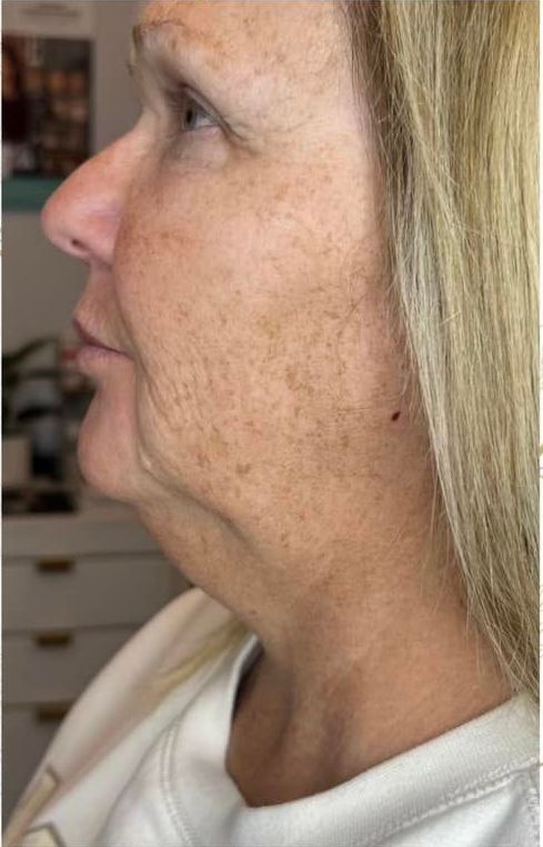A close up of a woman 's face and neck.