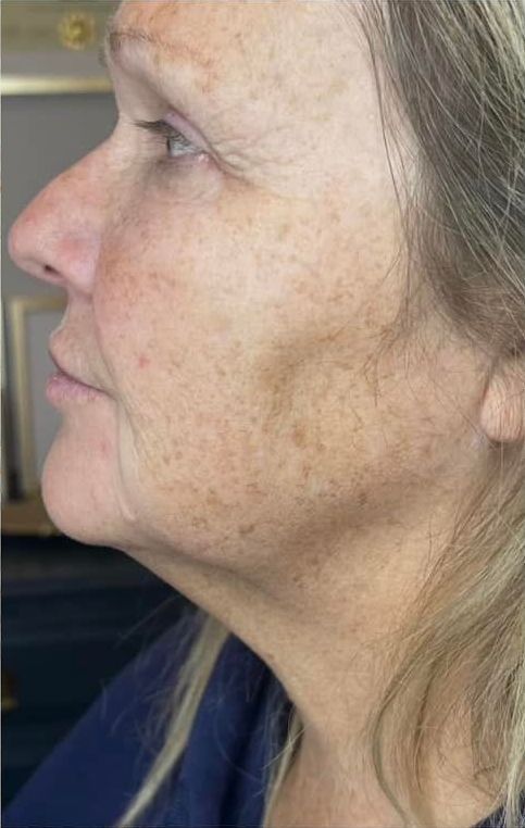 A close up of a woman 's face and neck without makeup.