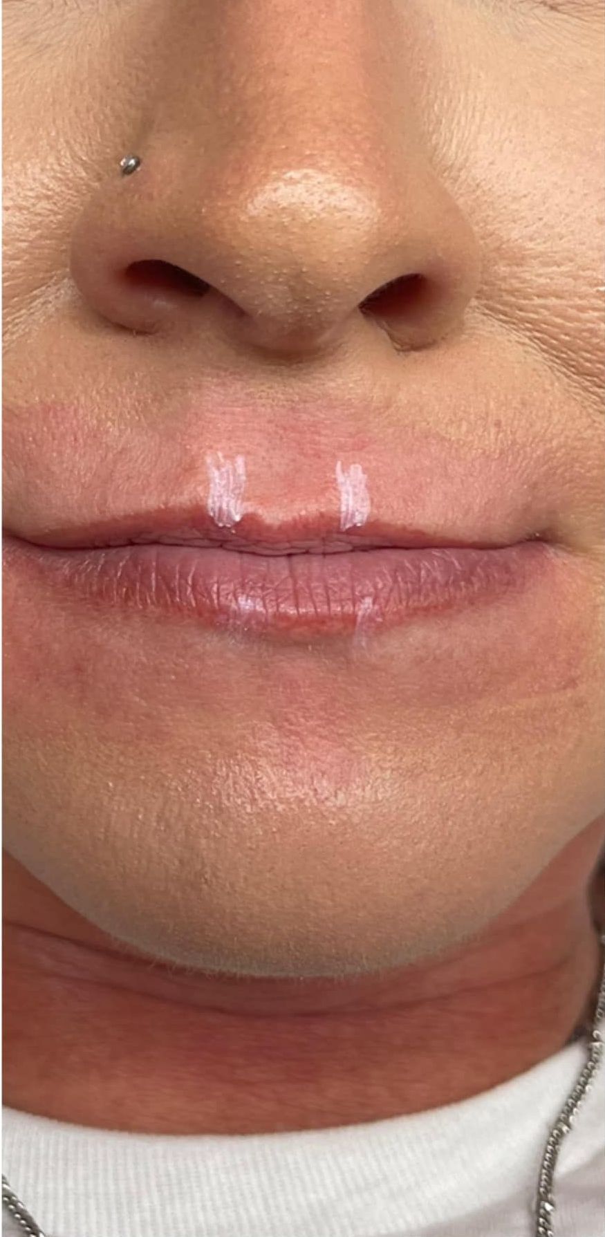 A close up of a woman 's lips and nose.