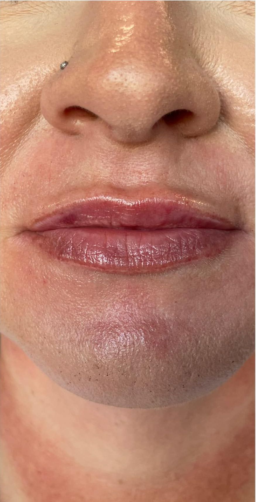 A close up of a woman 's lips and nose.