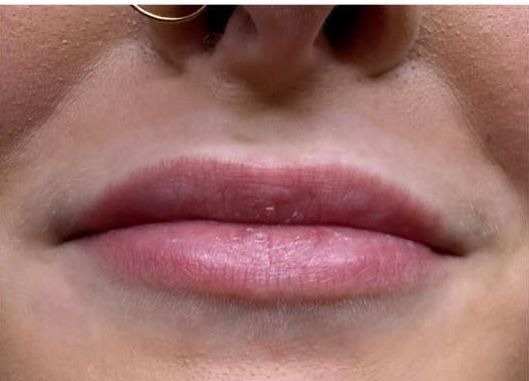 A close up of a woman 's lips with a nose ring.