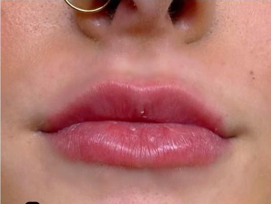 A close up of a woman 's lips with a nose ring.
