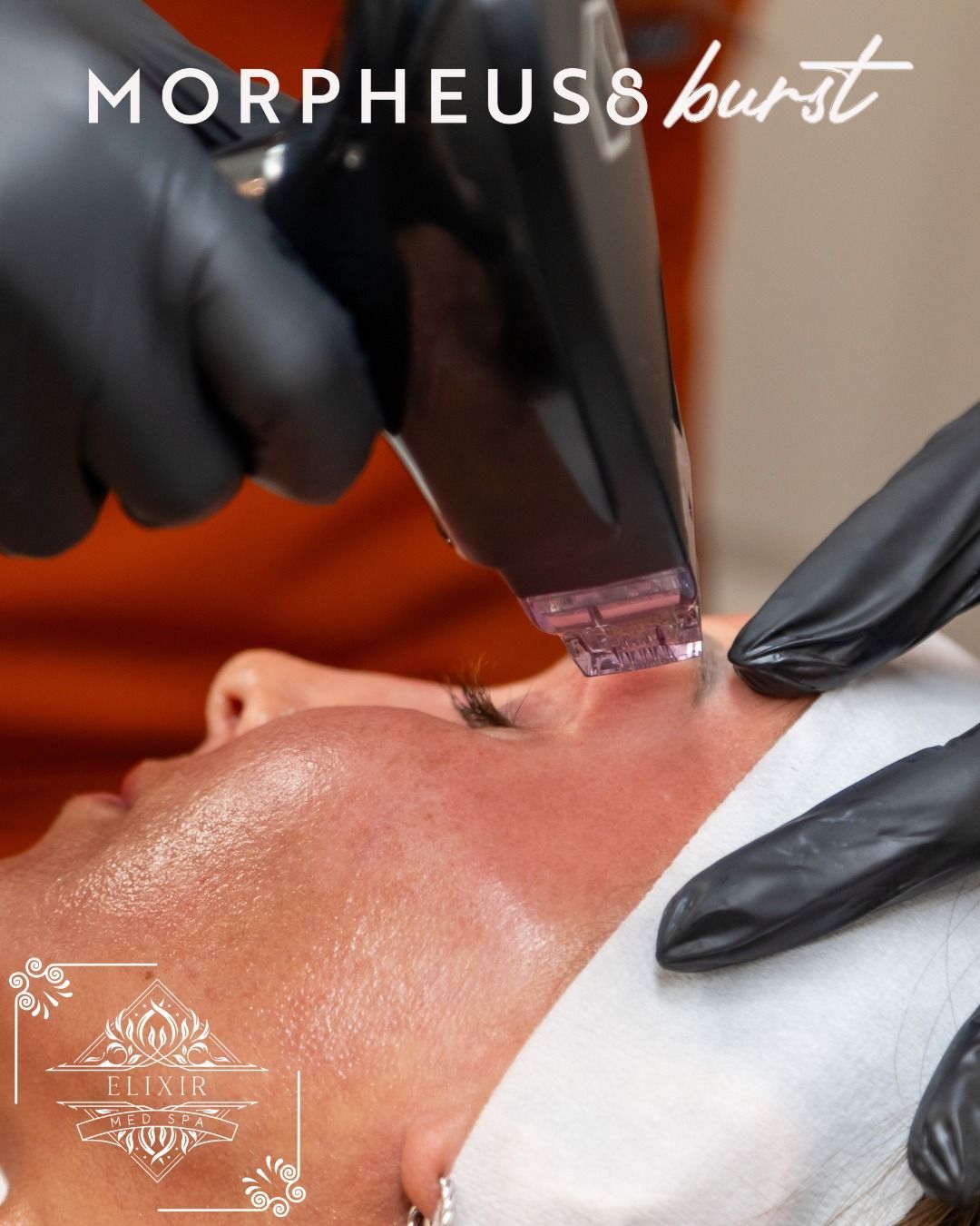 A woman is getting a morpheus burst treatment on her face