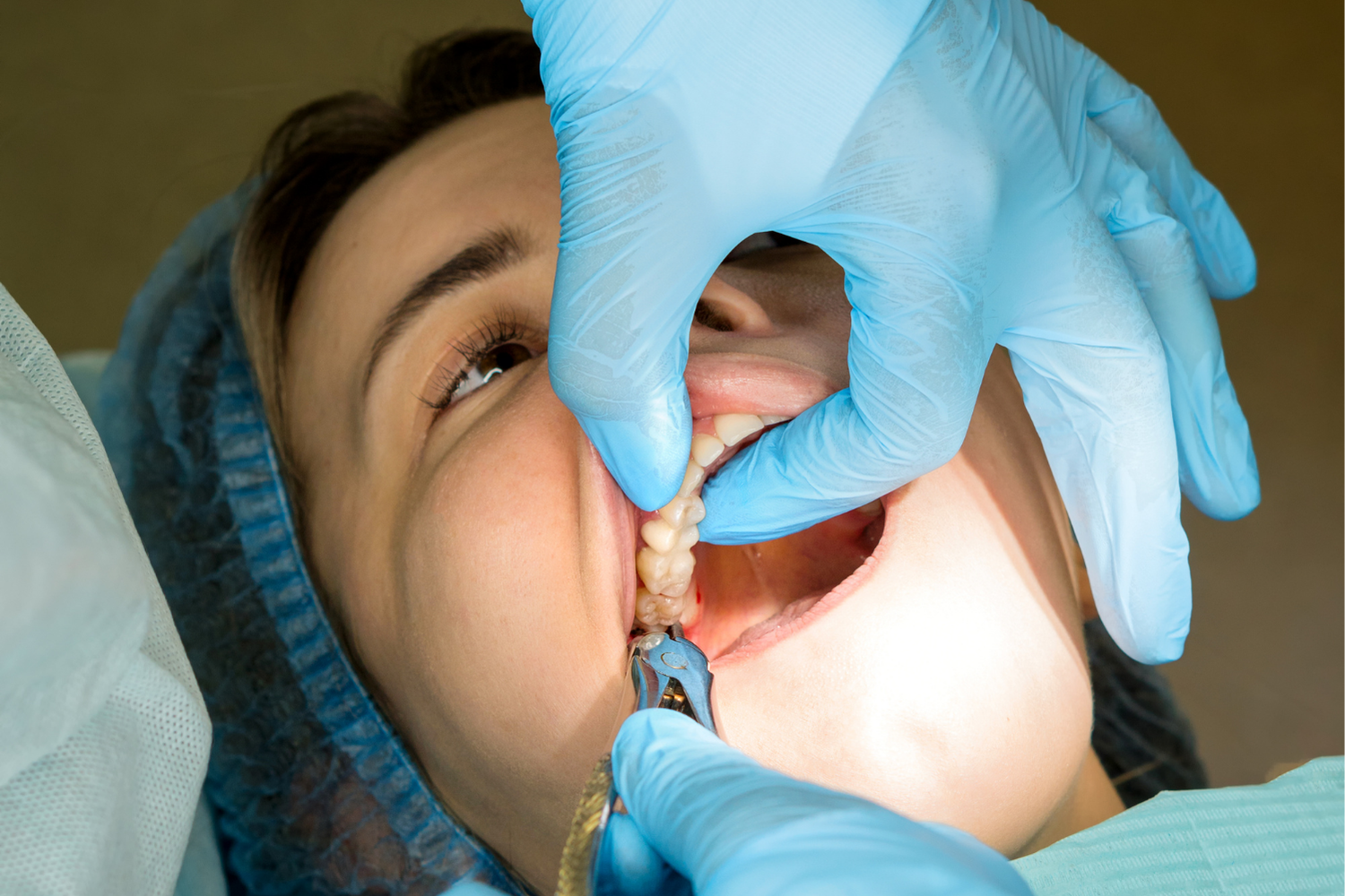 Dentist using gloved hands to examine a patient’s mouth during a dental procedure
