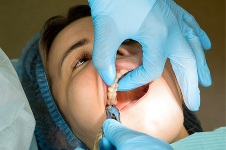 Dentist using gloved hands to examine a patient’s mouth during a dental procedure