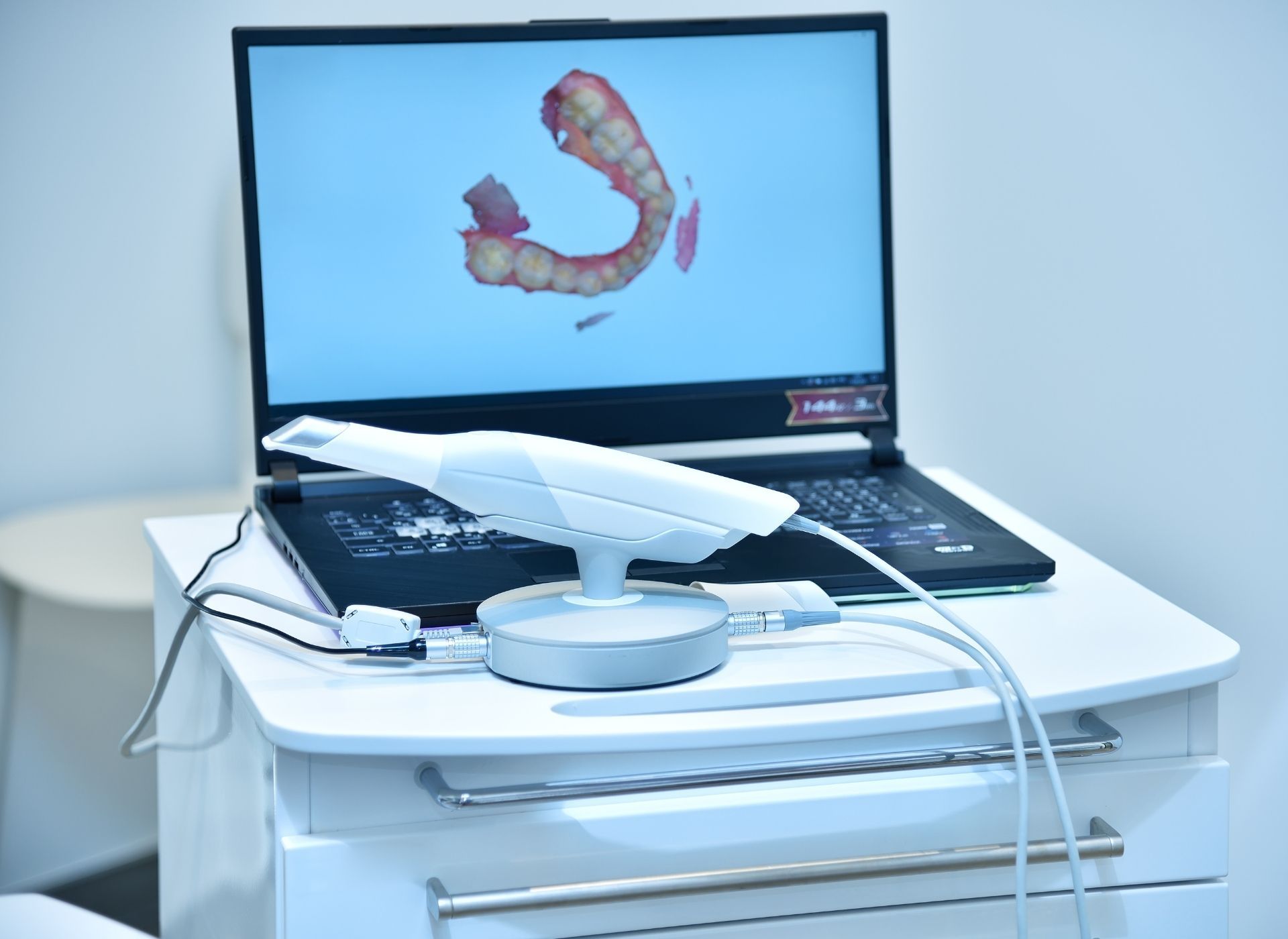 Laptop with medical scan on screen beside an ultrasound probe and cables on a white table