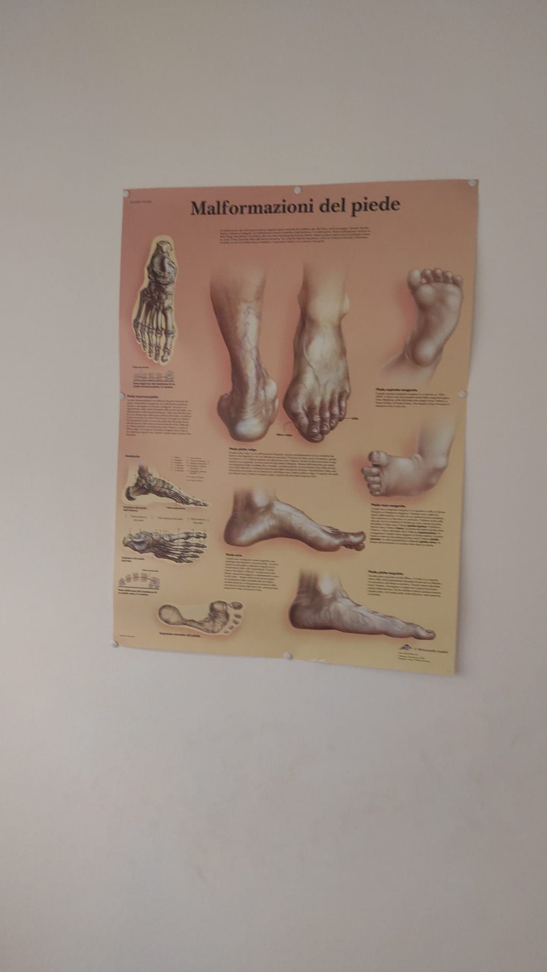 riflessologia
