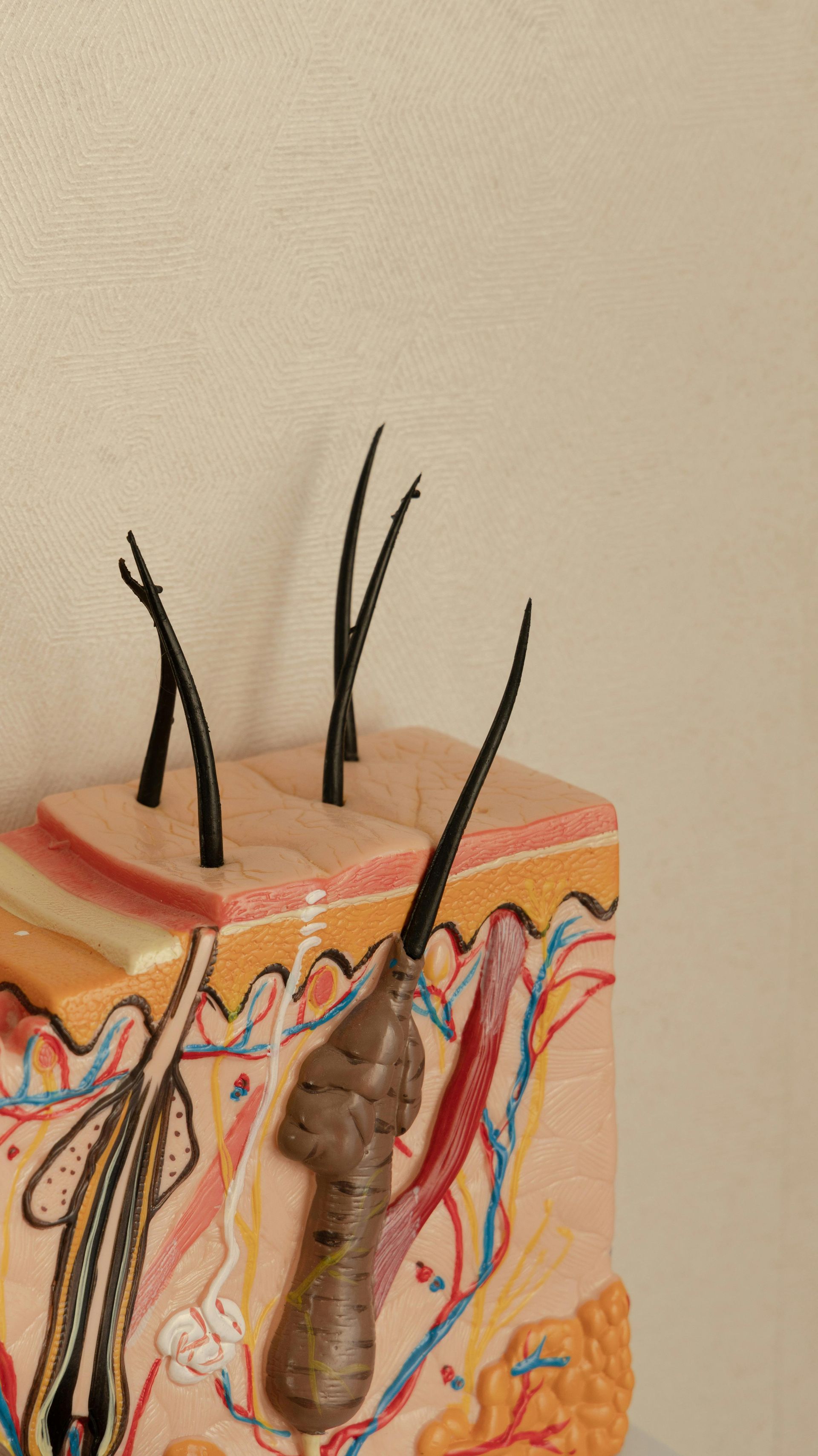 Musculoskeletal Soft Tissue