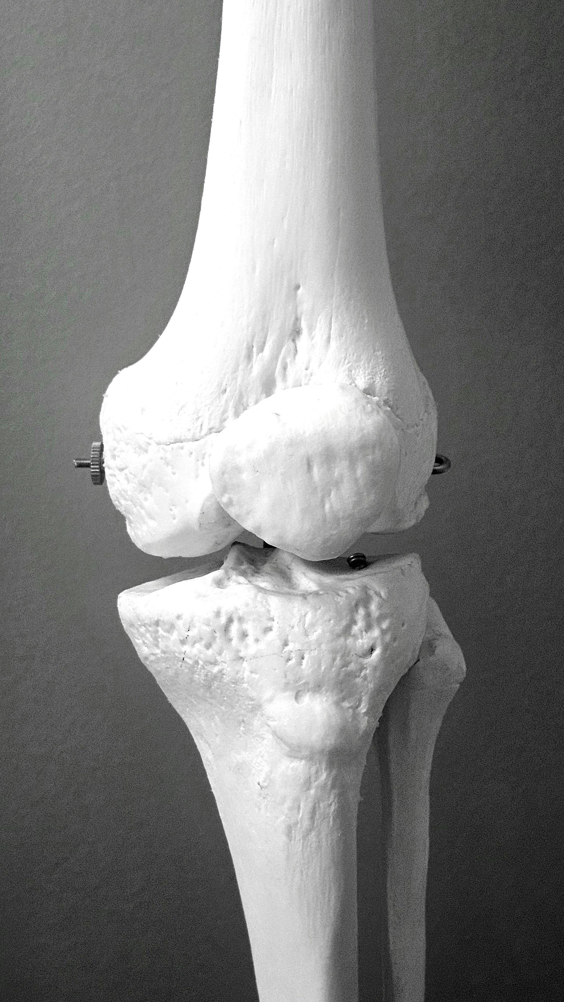 Musculoskeletal (CP-MSK)