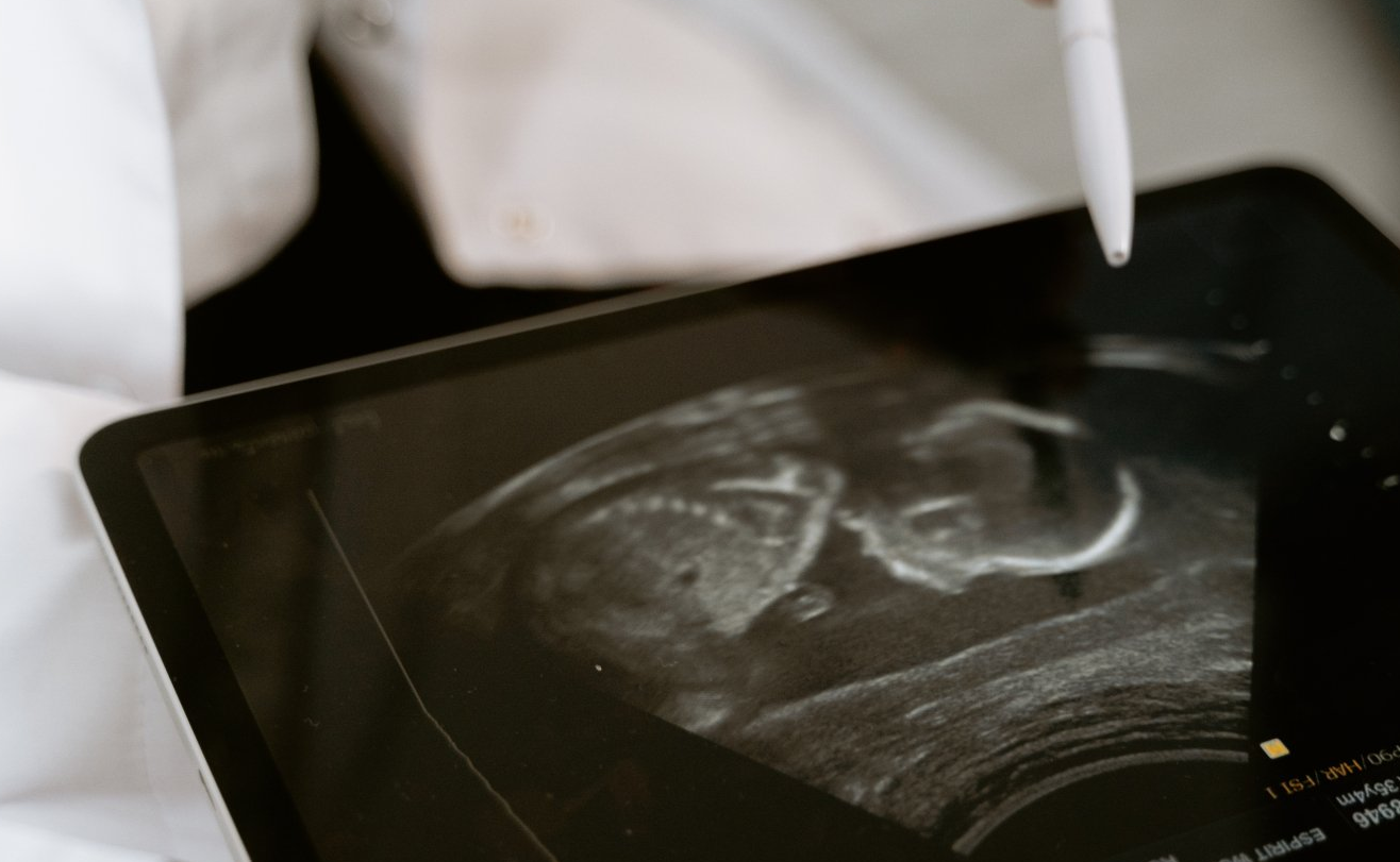 Ultrasound Biophysical Profile (BPP), online and in-person programs.