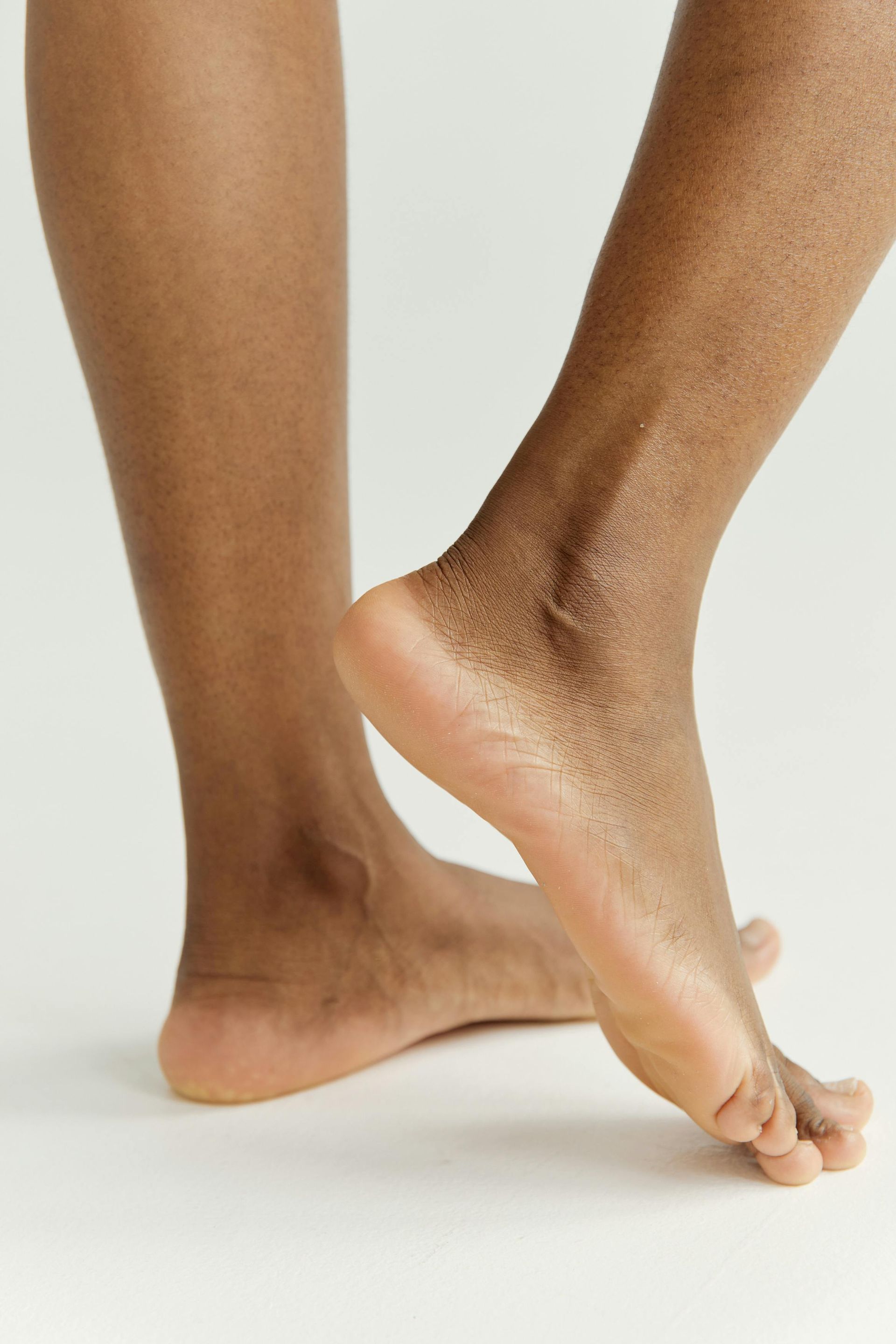 Lower Extremity Deep Vein Thrombosis