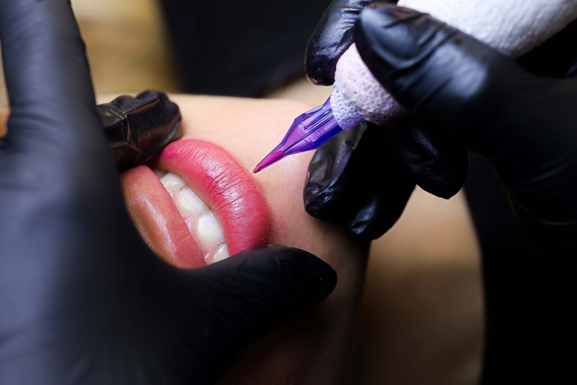 Lippen