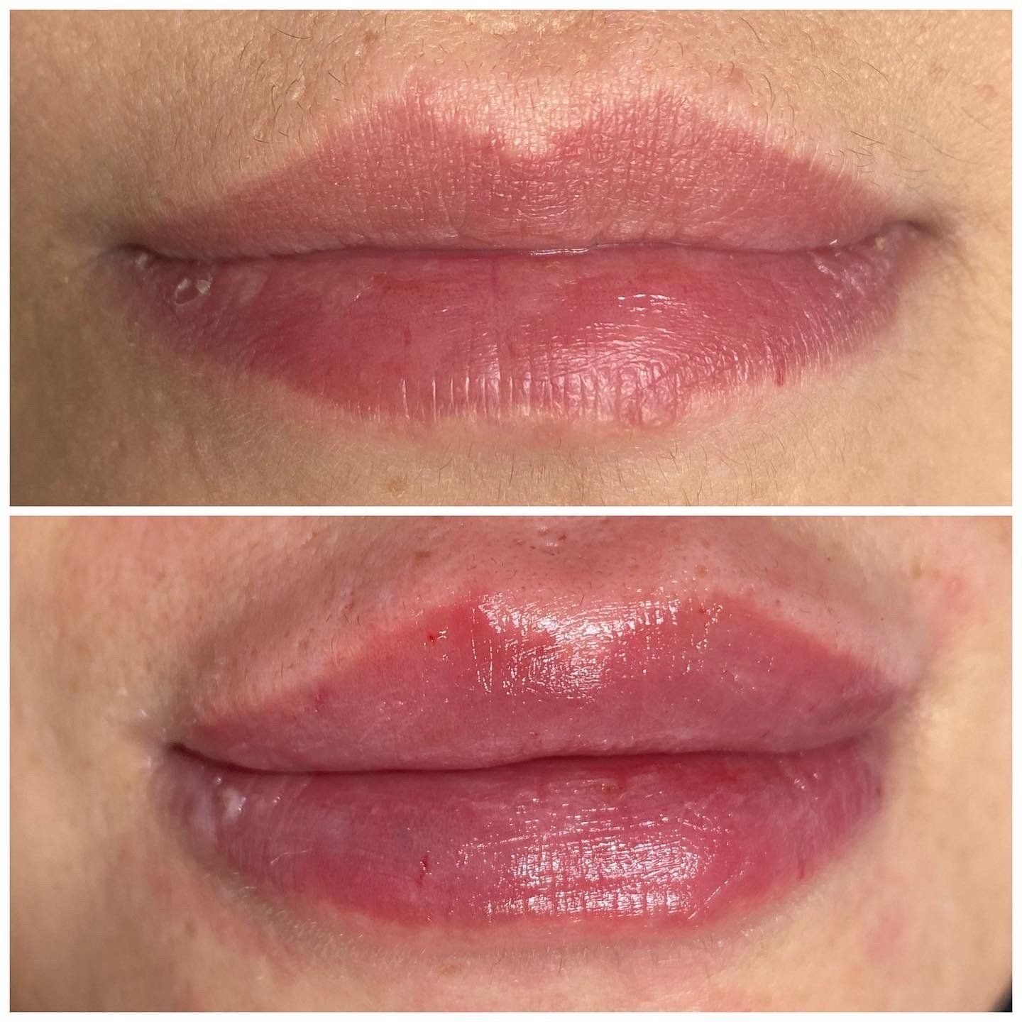 Ein Vorher-Nachher-Foto der Lippen einer Frau.