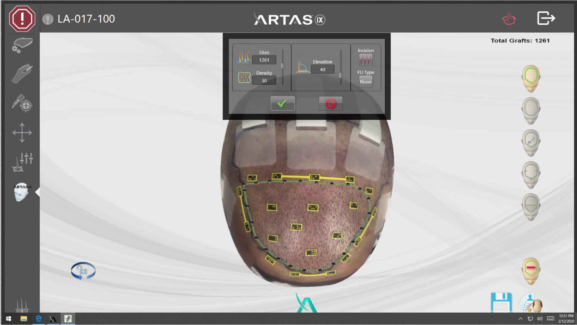 Screen showing AI