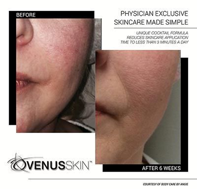 A before and after photo of a woman 's face