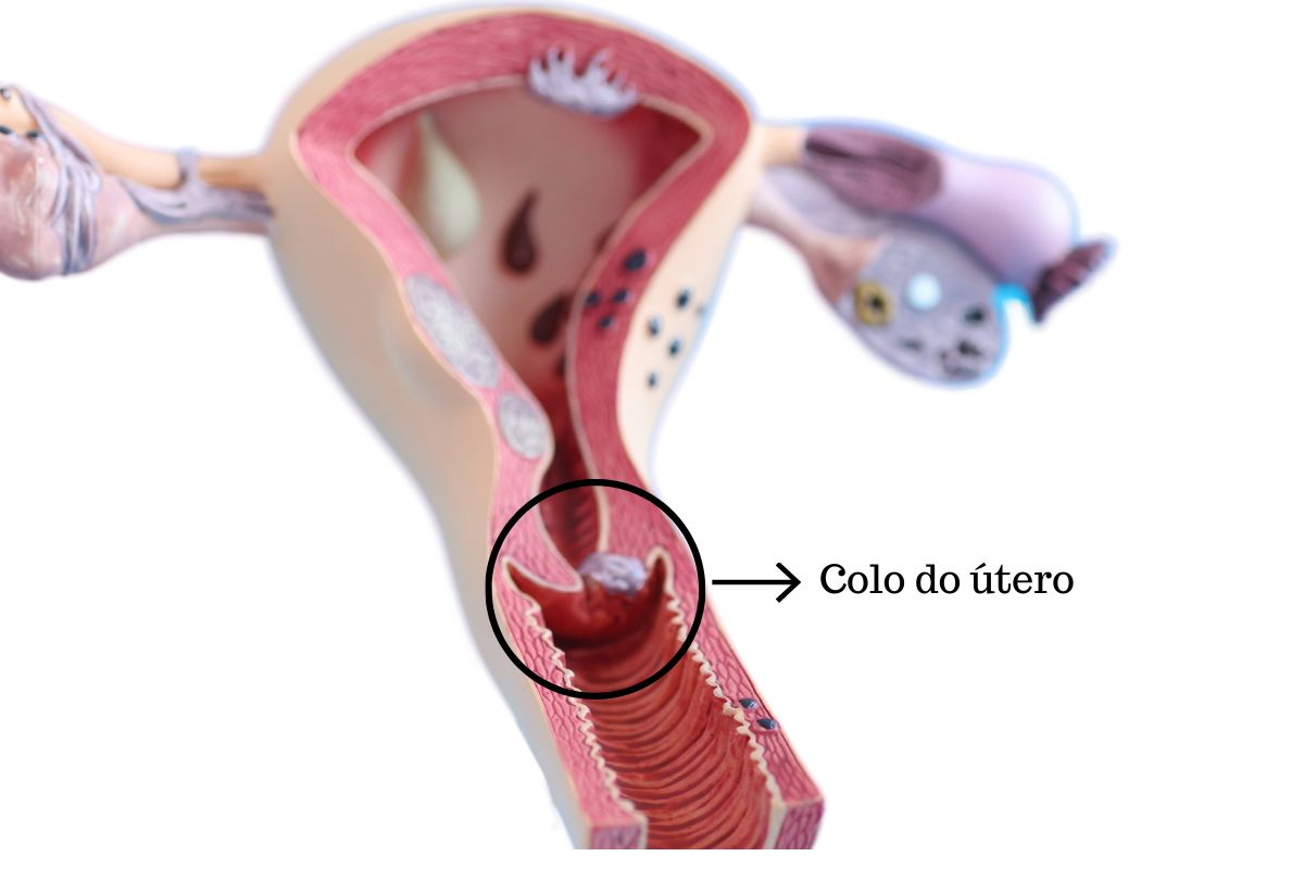 colo-do-utero-dra-juliana-ribeiro-ginecologista-sao-paulo