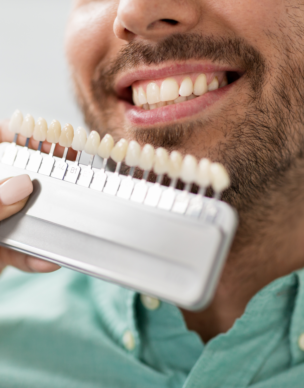 Porcelain Veneers in Tustin CA