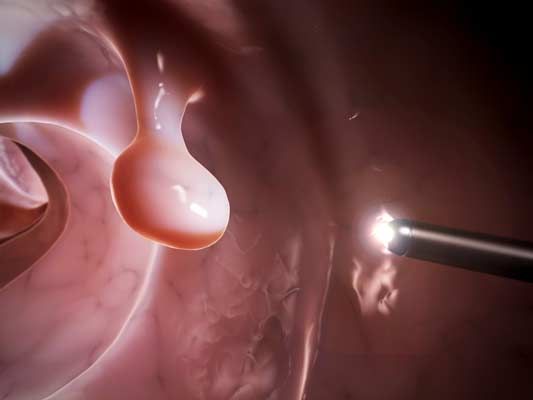 endoscopía digital digestiva