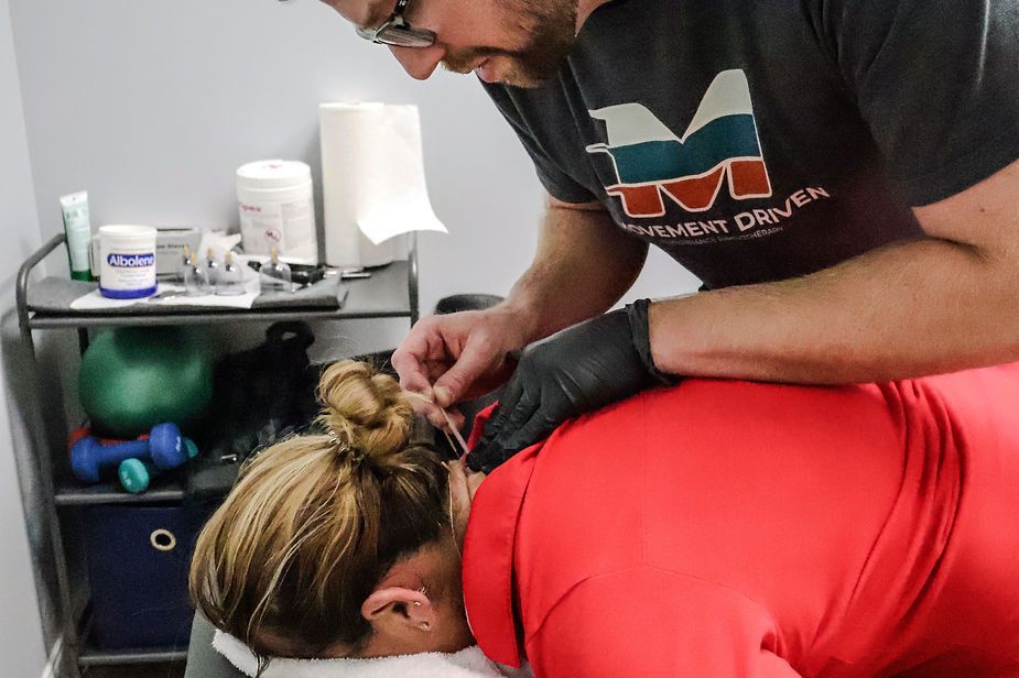 A man is giving a woman an acupuncture treatment. A man is giving a woman an acupuncture treatment.