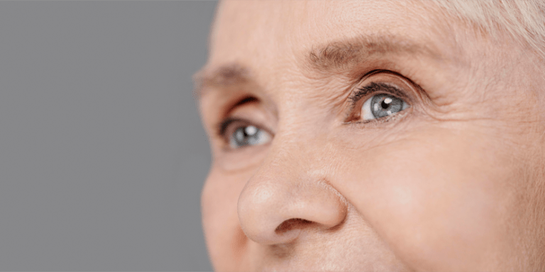 olhos de idosa com glaucoma