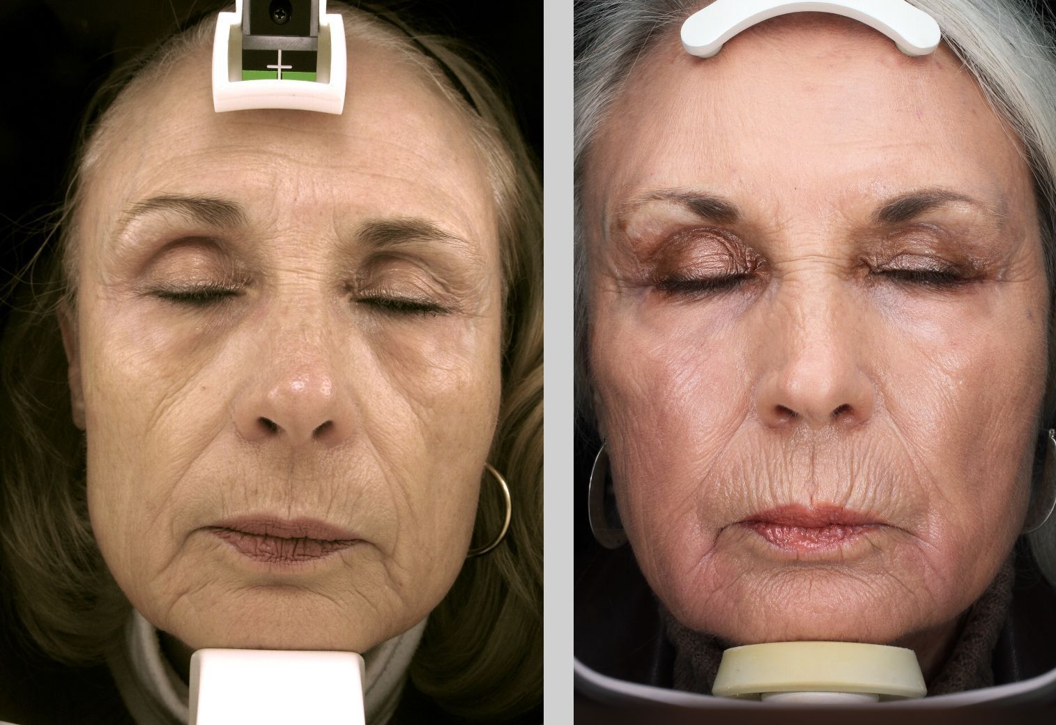 A before and after photo of a woman 's face with her eyes closed.