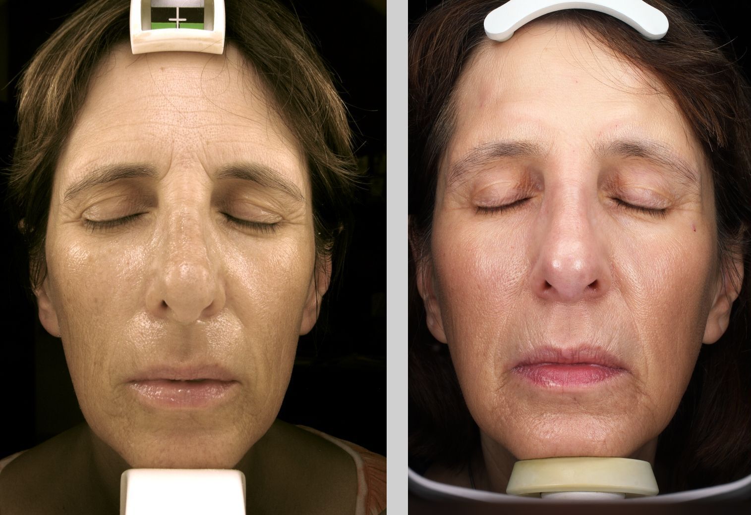 A before and after photo of a woman 's face with her eyes closed.