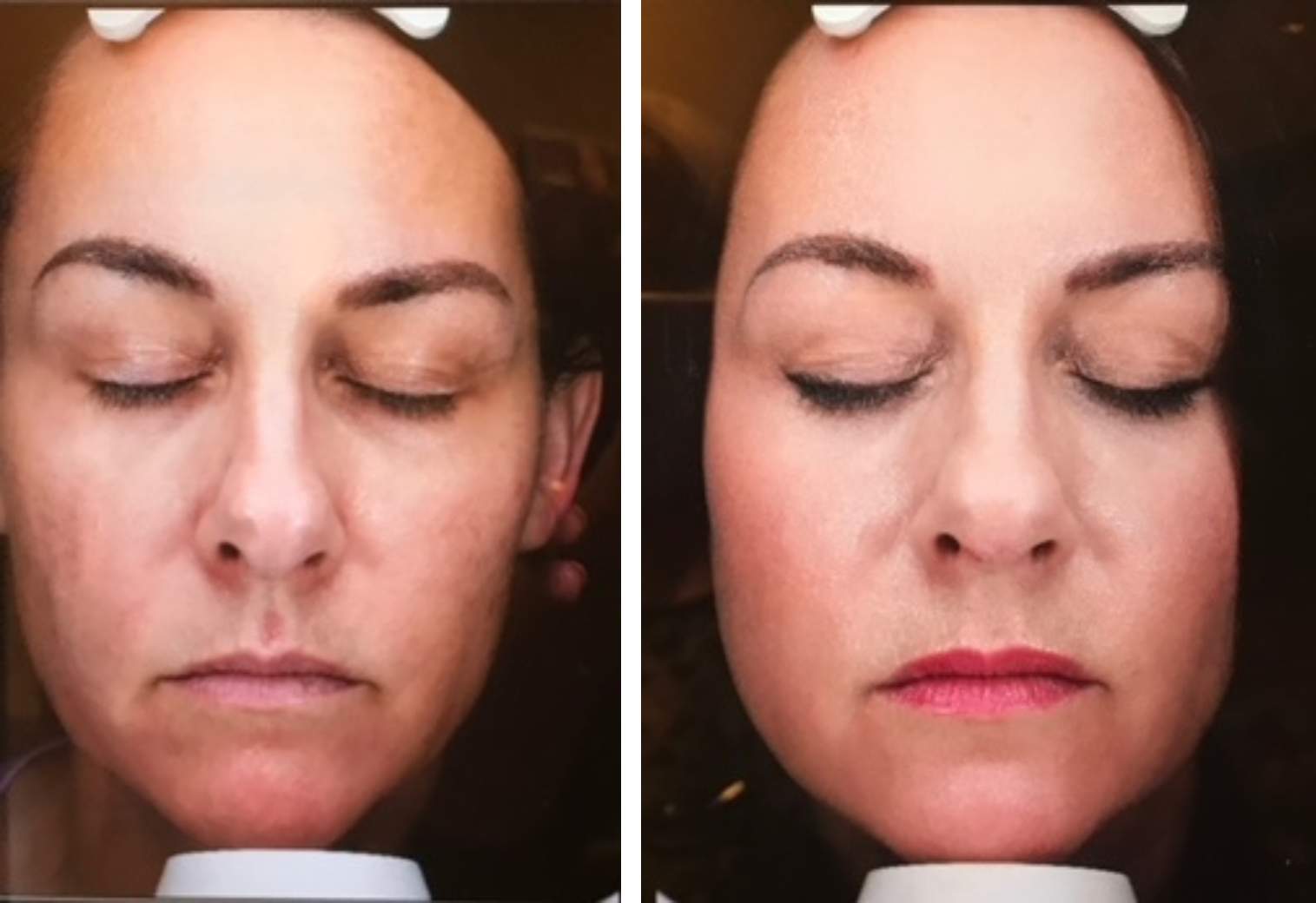 A before and after photo of a woman 's face with her eyes closed
