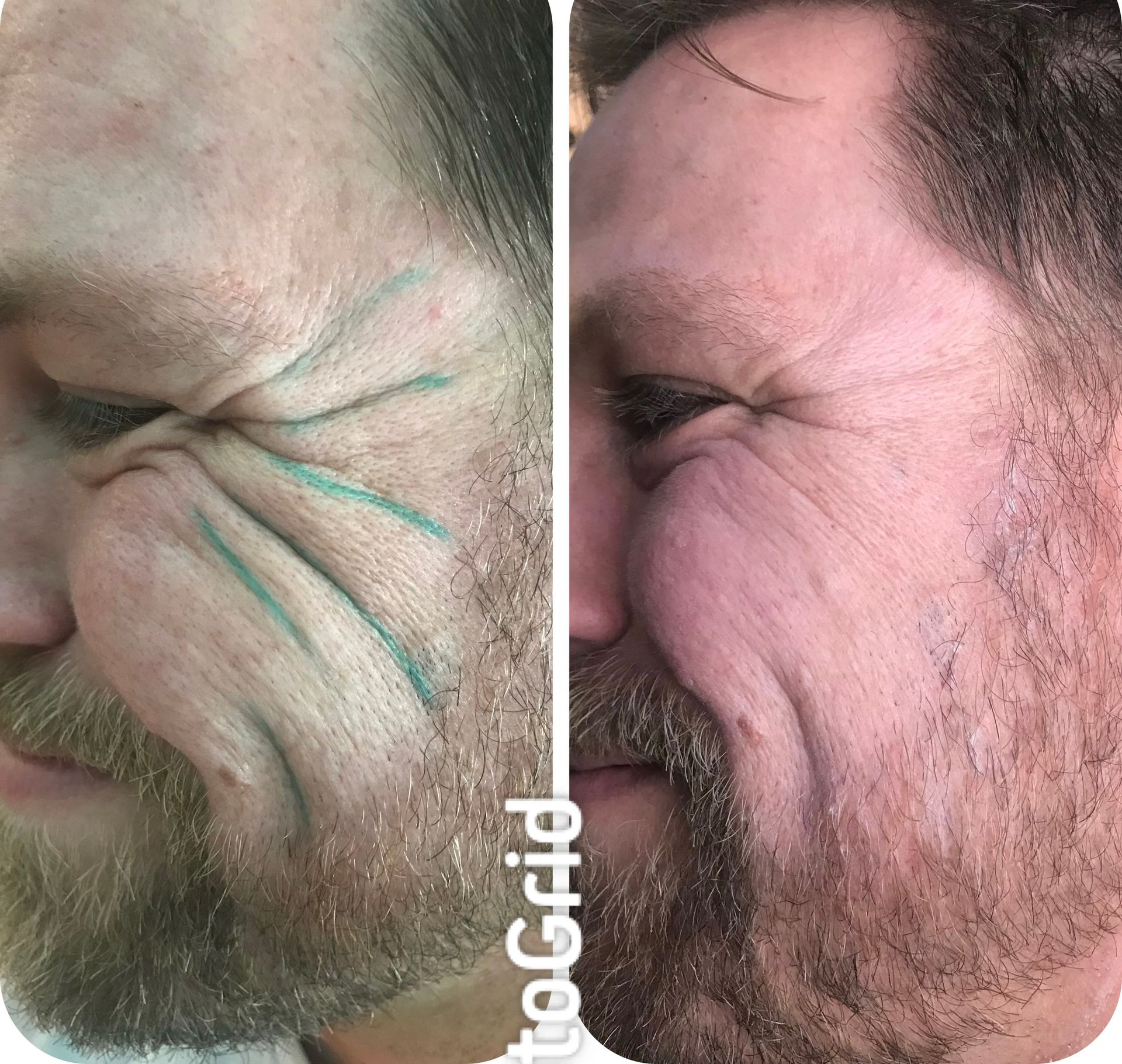 A before and after photo of a man with a beard