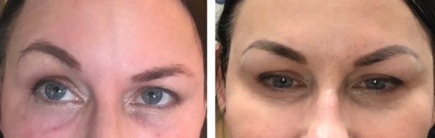 A before and after photo of a woman 's face
