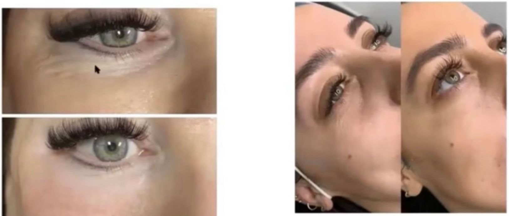 A before and after picture of a woman 's eye.
