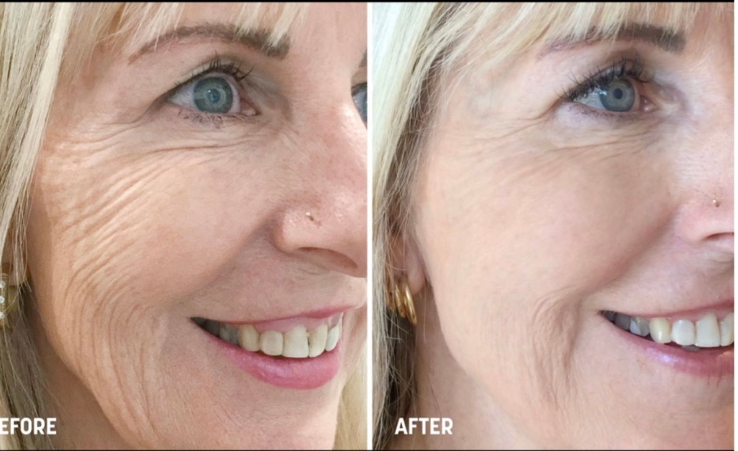 A before and after photo of a woman 's face.