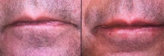 A close up of a man 's lips with a beard.