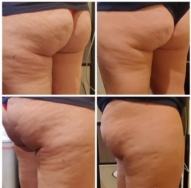 skin 3
