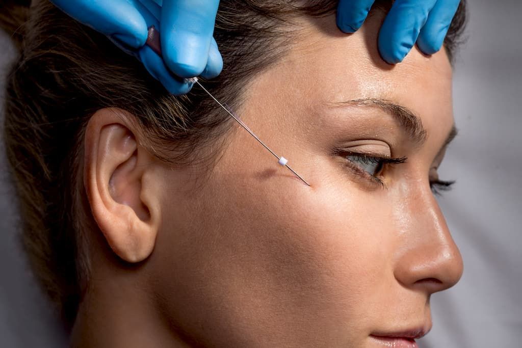 A woman is getting a botox injection in her forehead.