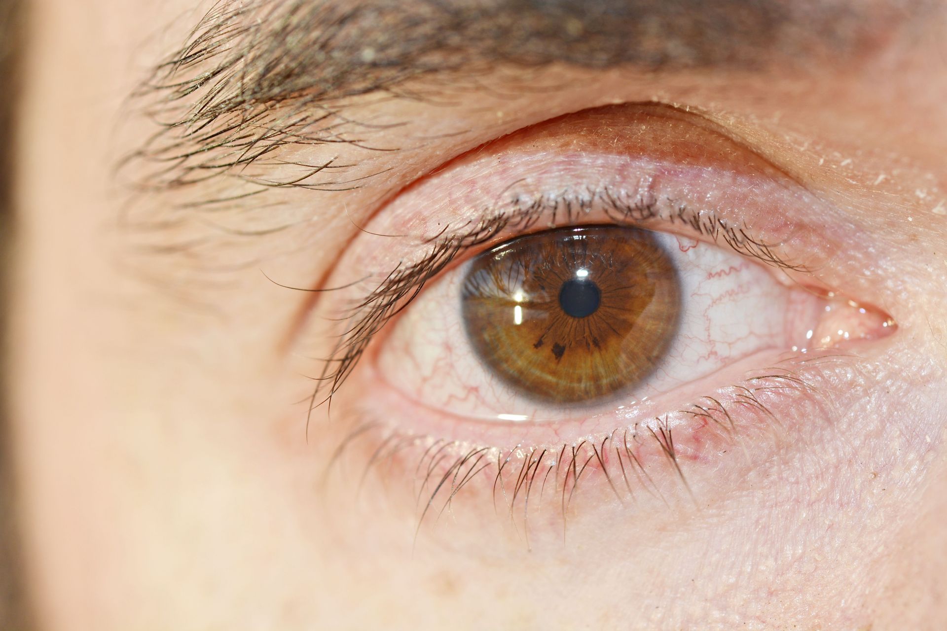 Close-up of a brown eye with light eyelashes and skin, showing the iris and pupil clearly