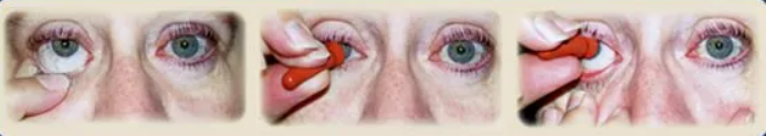 Removing With A Suction Cup — Cox Ocular Prosthetics, Inc. — Birmingham, AL Removing With A Suction Cup — Cox Ocular Prosthetics, Inc. — Birmingham, AL