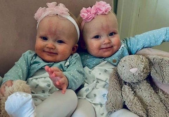 Two smiling babies in pastel outfits with pink headbands, sitting together with a gray stuffed bunny