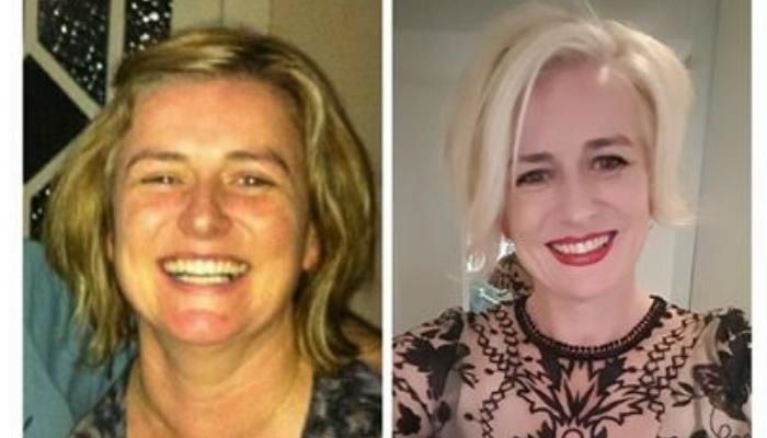 Body Transformation of Fiona before and after photos side by side comparisons