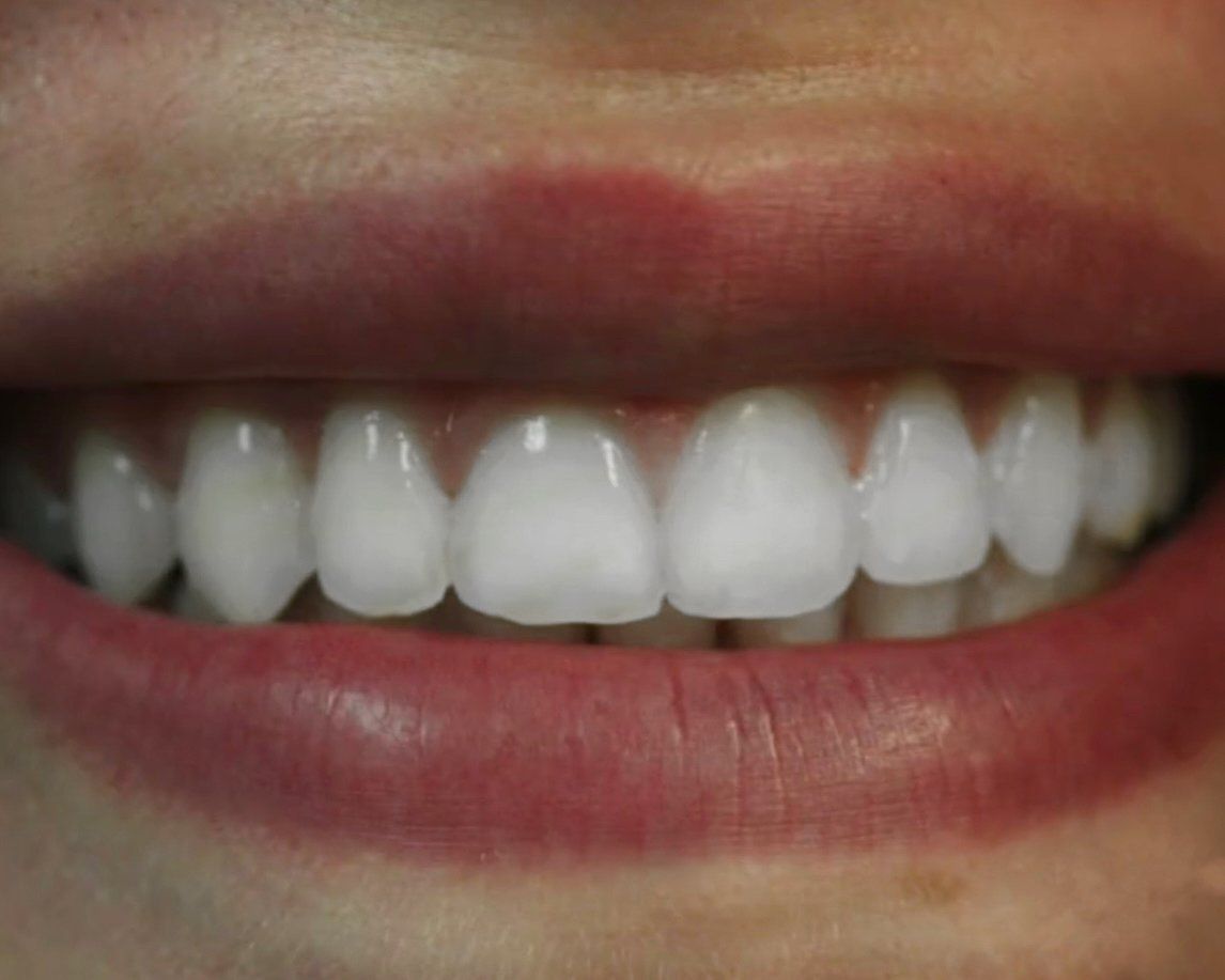 before and afters Dr. A. Christopher Bernardini