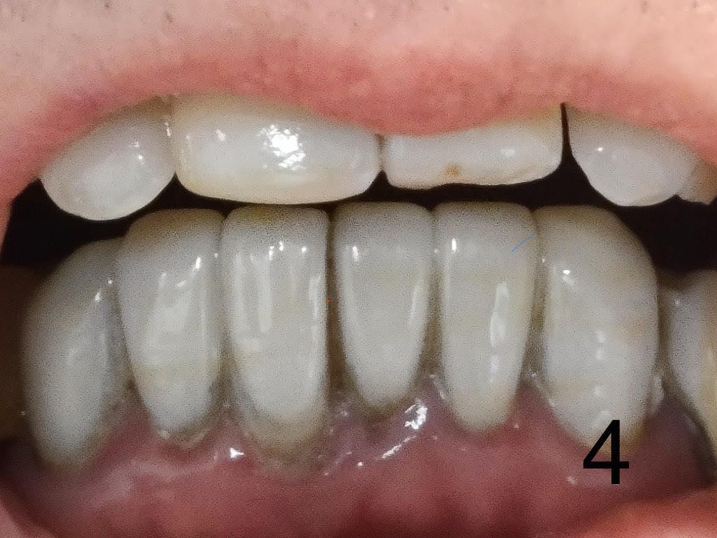 restorative after