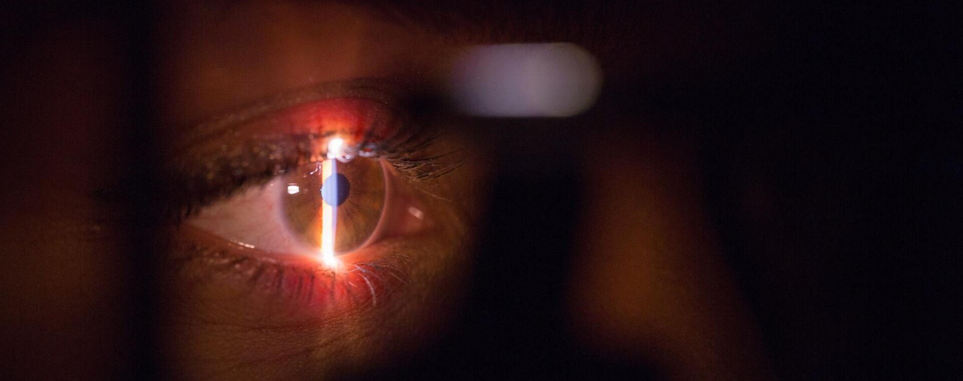 eye exam