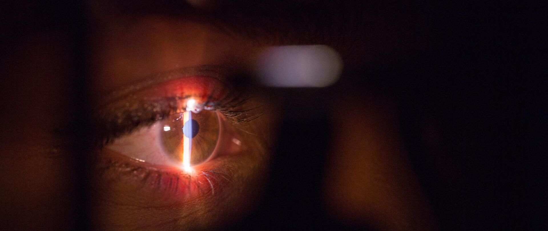eye exam