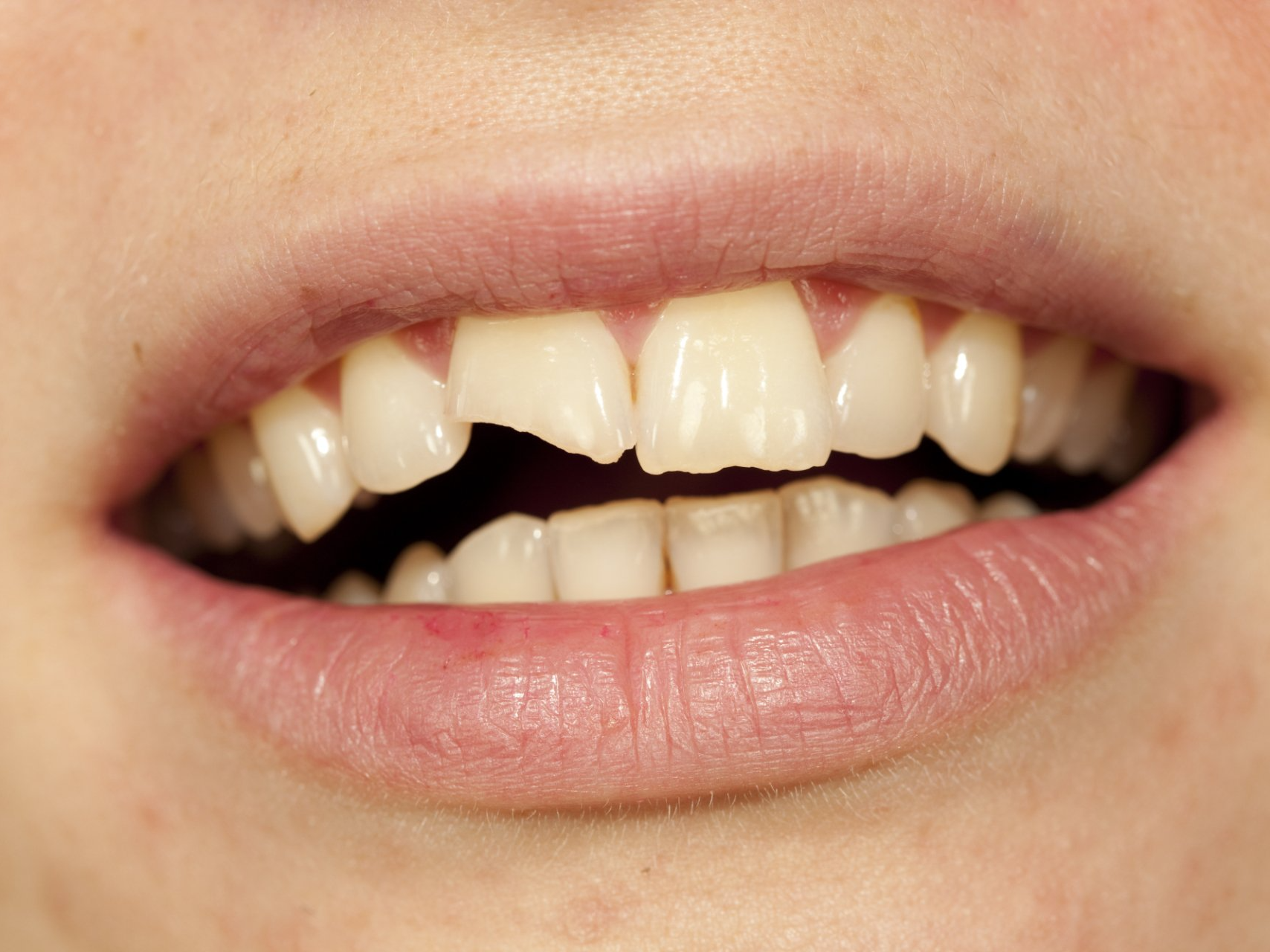 middle age woman looks at new dentures in hand mirror
