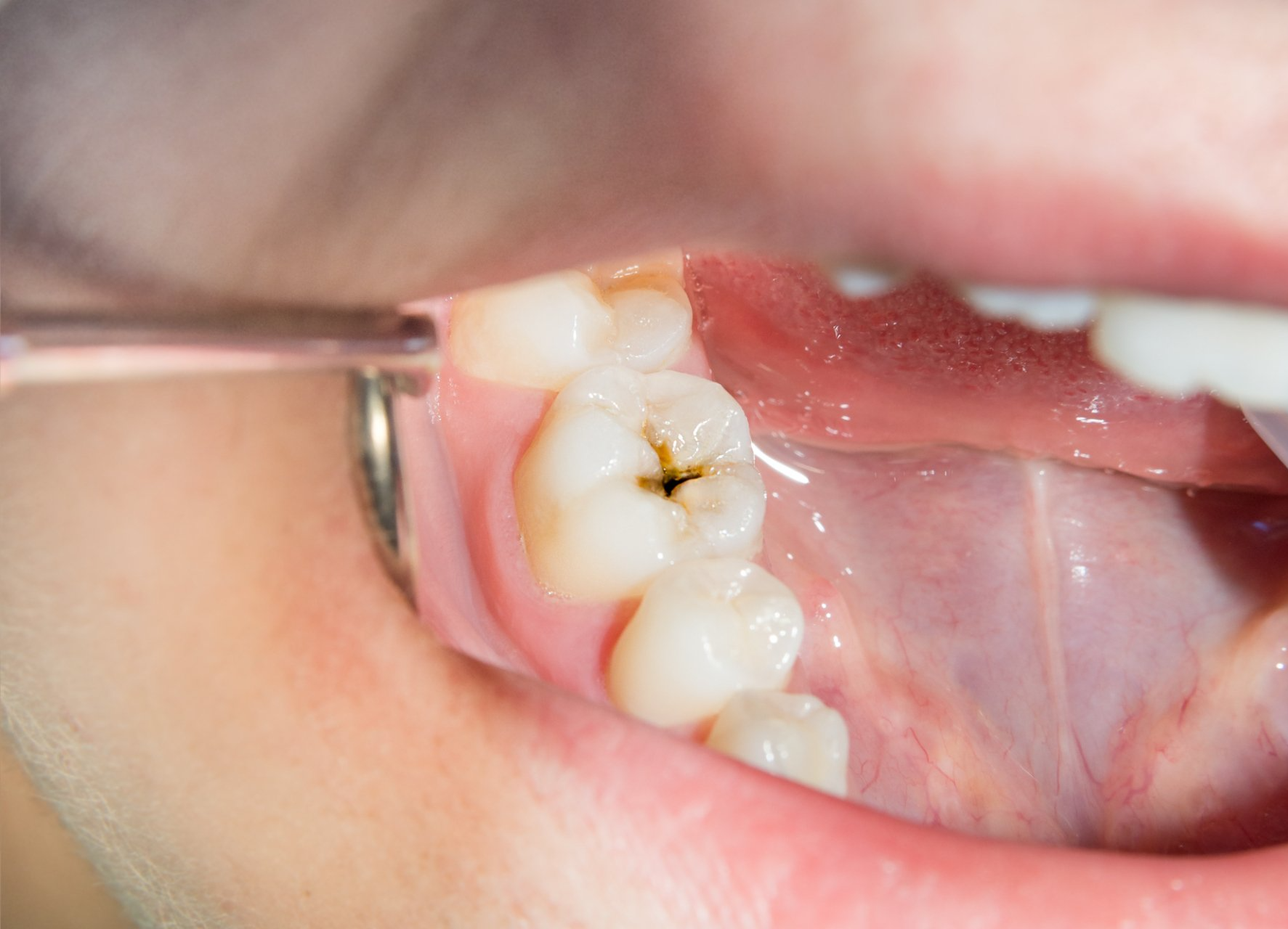dental assistant examining a patient's teeth