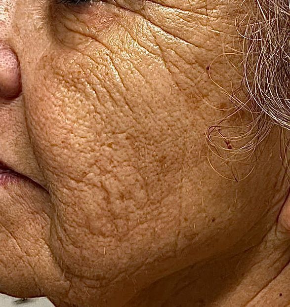 Eine Nahaufnahme des Gesichts einer Frau vor unscharfem Hintergrund.