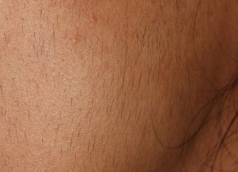 Close-up of tan skin with a single dark strand of hair against a plain background