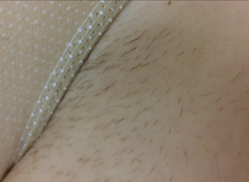 Close-up of skin with sparse body hair beside a beige fabric strap with white dots